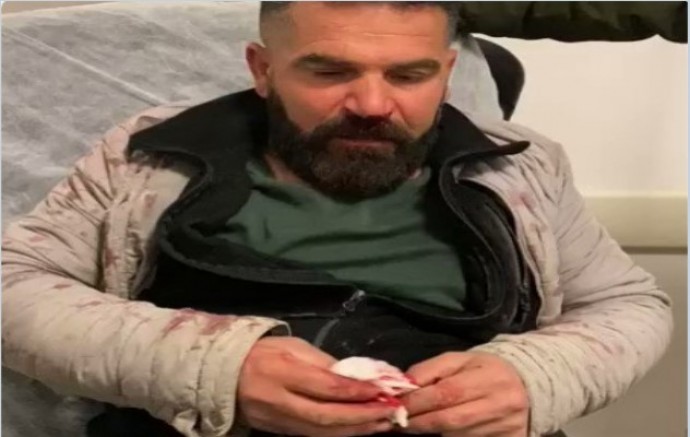 AKP'li Ağrı Belediyesi Başkanı Savcı Sayan’ın şantiye işçilerini dövdüğü iddia edildi (VİDEO)