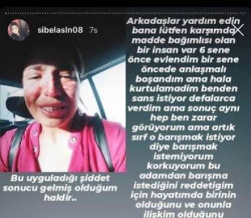 Boşandığı eşinden şiddet gören kadının yardım çığlığı: Ben ölmeden sesim olun!