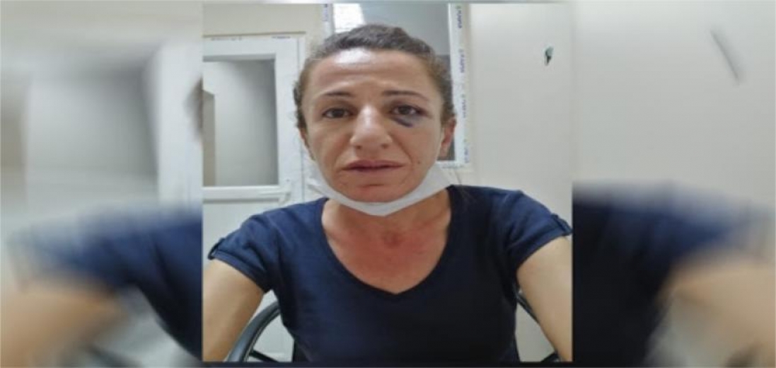 Burası İsrail Türkiye değil! 