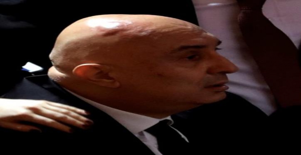 CHP Grup Başkanvekili Engin Özkoç'un Meclis'te AKP'li vekillerin saldırısı sonrası hali