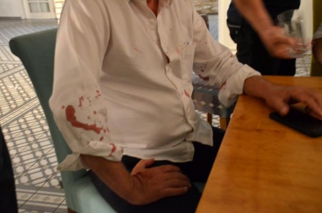 Didim Belediye Başkanına beyzbol sopalı saldırı!