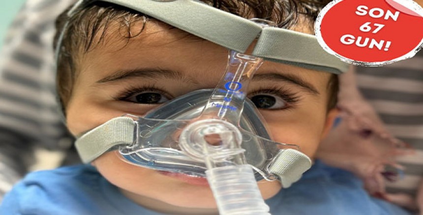 Diyarbakırlı SMA’lı Azer Bebek Yaşamak İçin Yardımlarınızı Bekliyor