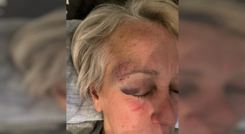 Göbeklitepe'yi keşfeden Klaus Schmidt'in eşi Urfa’da saldırıya uğradı: “Öldüreceğim seni” diyordu