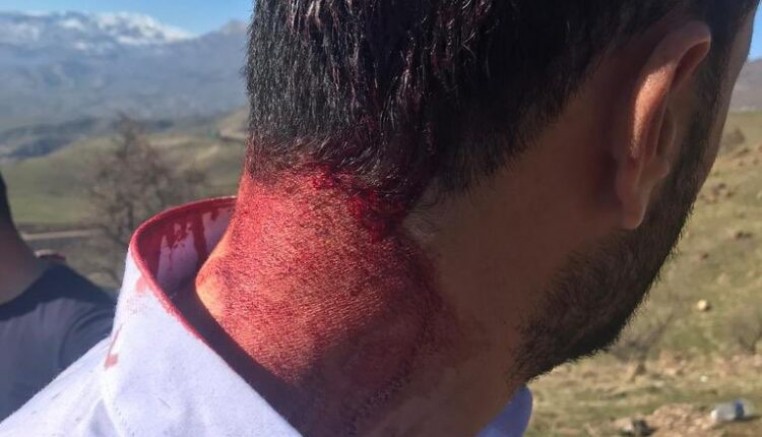 HDP’li vekil: Hakkari’de piknik alanındaki gençlere ateş açıldı (VİDEO)