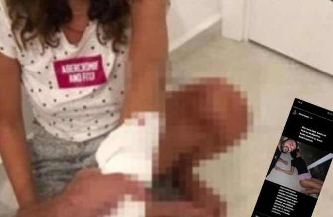 İşkence görüntülerini sosyal medyadan paylaşan İrem Ay: Süreci herkes bilecek