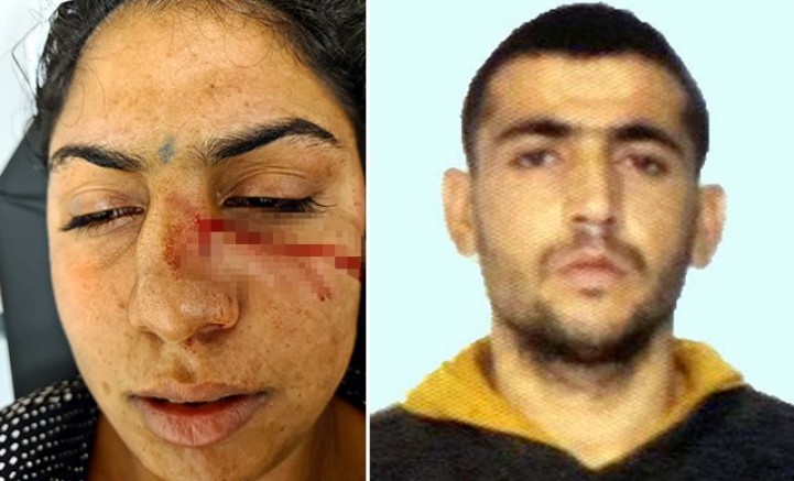 Kahvaltı hazırlamadığı için eşini döverek burnunu kırdı