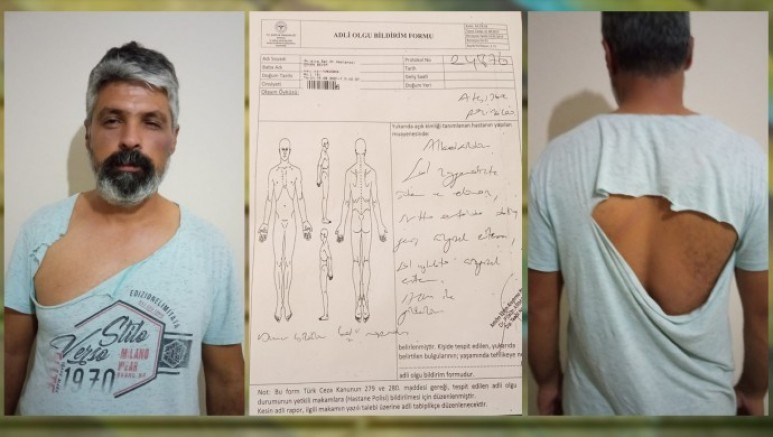 Kepez’de Yol kontrolü yapan ırkçı Faşistler bir kişiyi darp etti