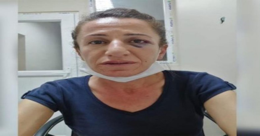 Rojbin Çetin Çetin tutuklandı