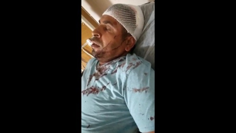 Sakarya'da mevsimlik işçiye ırkçı saldırı 