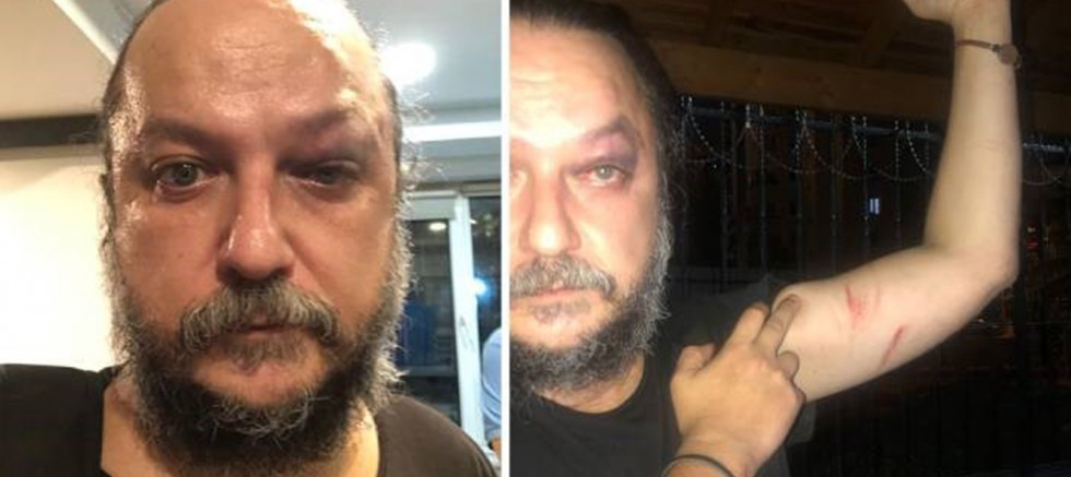 Sanatçı Güvenç Dağüstün, konser sonrası saldırıya uğradı 