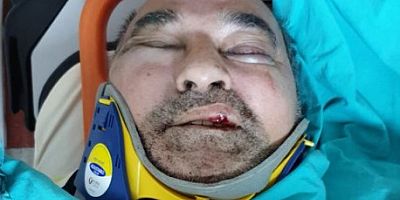 Aydın'ın Kuşadası ilçesinde yaşayan yazar Ergün Poyraz'a saldırı