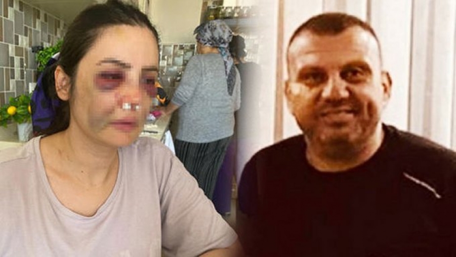 Ülkemizde her gün kadınlar şiddete uğruyor ve ya öldürülüyor 